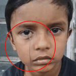 टॉय कार से निकलकर तार बच्चे की आंख में घुसा:घर में खेलते समय हादसा, पिता ने एक दिन पहले 250 रुपए में दिलाई थी | ACTPnews