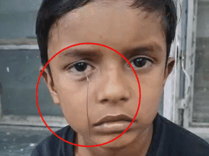 टॉय कार से निकलकर तार बच्चे की आंख में घुसा:घर में खेलते समय हादसा, पिता ने एक दिन पहले 250 रुपए में दिलाई थी | ACTPnews