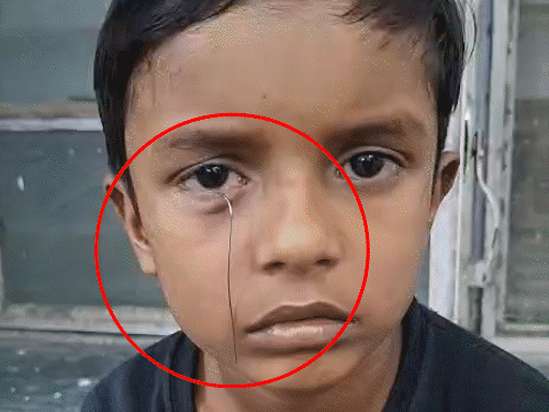 टॉय कार से निकलकर तार बच्चे की आंख में घुसा:घर में खेलते समय हादसा, पिता ने एक दिन पहले 250 रुपए में दिलाई थी