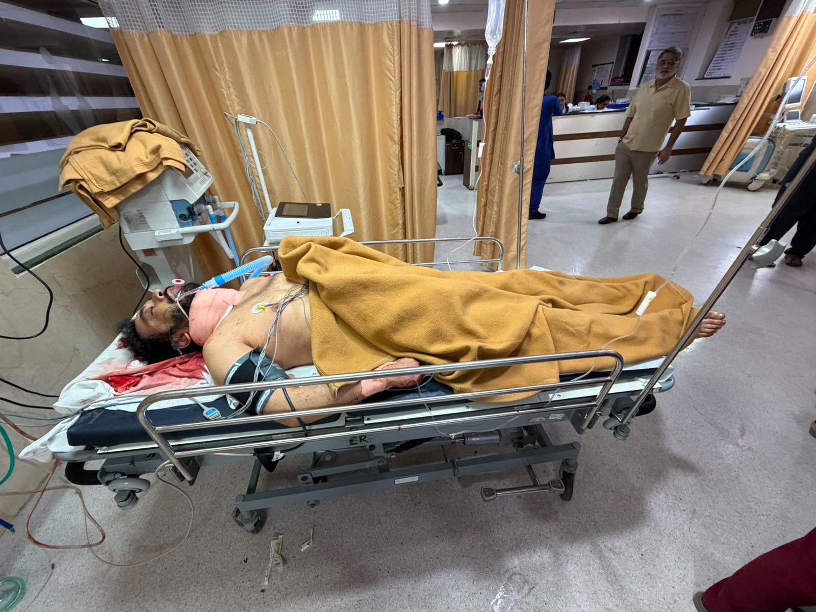 अस्पताल में भर्ती आरोपी युवक। उसने एक्स-गर्लफ्रेंड की हत्या के बाद खुद सुसाइड की कोशिश की थी।