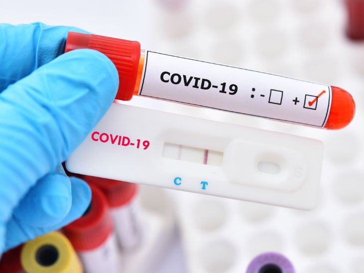 Andhra Pradesh Covid Update | Samples Sent To Pune NIV For Genome Testing | ACTPnews