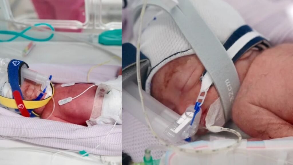 ऑस्ट्रेलियाई महिला ने दिया एक जैसी दिखने वाली 4 बच्चियों को जन्म, डॉक्टर्स रह गए दंग, कहा- ‘ये बेहद दुर्लभ’ | ACTPnews
