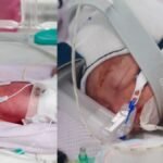 ऑस्ट्रेलियाई महिला ने दिया एक जैसी दिखने वाली 4 बच्चियों को जन्म, डॉक्टर्स रह गए दंग, कहा- ‘ये बेहद दुर्लभ’ | ACTPnews