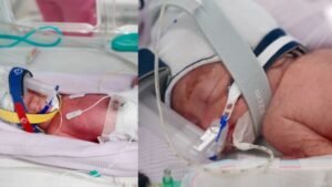 ऑस्ट्रेलियाई महिला ने दिया एक जैसी दिखने वाली 4 बच्चियों को जन्म, डॉक्टर्स रह गए दंग, कहा- ‘ये बेहद दुर्लभ’ | ACTPnews